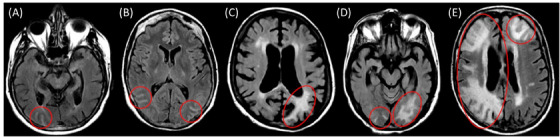 FIGURE 1