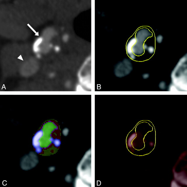 Fig 1.