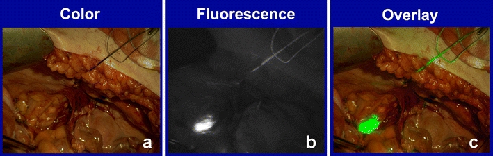 Fig. 3