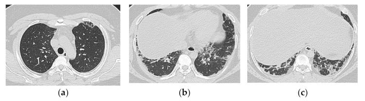 Figure 11