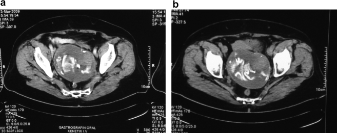 Figure 1