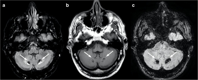 Fig. 13