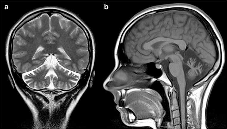 Fig. 10