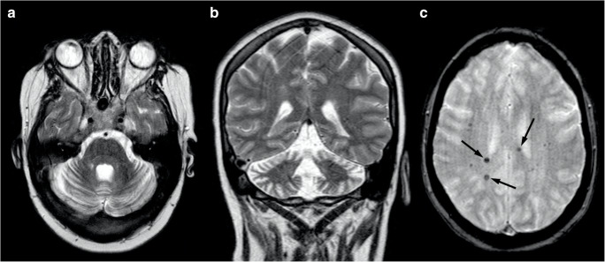 Fig. 12