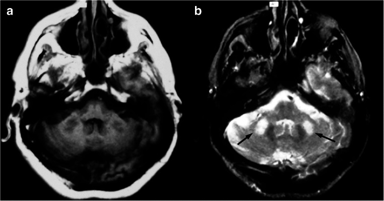 Fig. 15