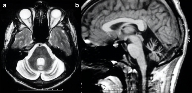 Fig. 9