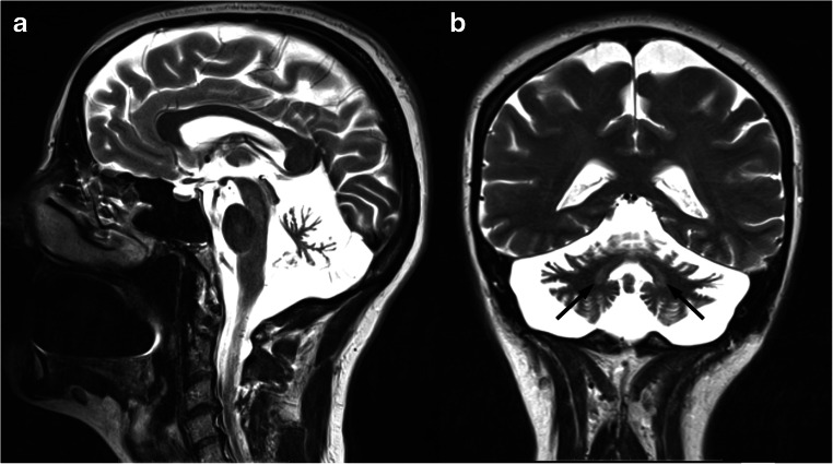 Fig. 14