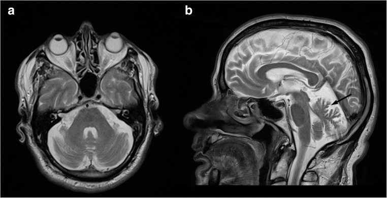 Fig. 11