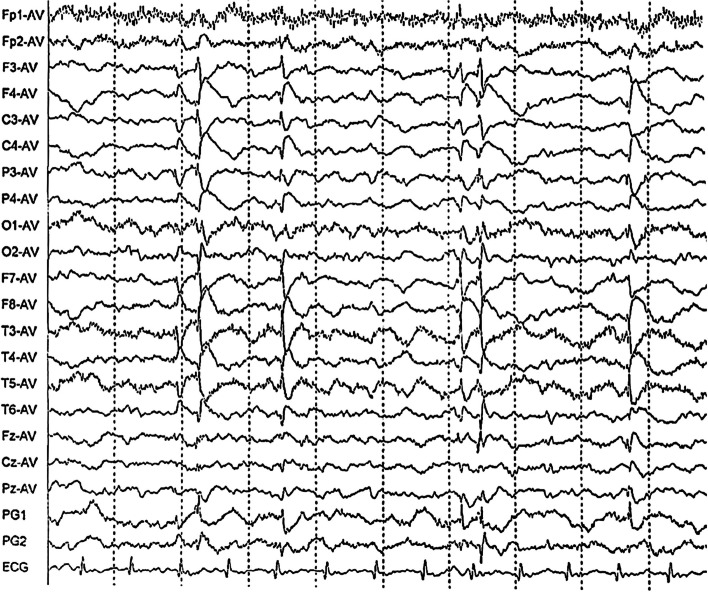 Fig. 1