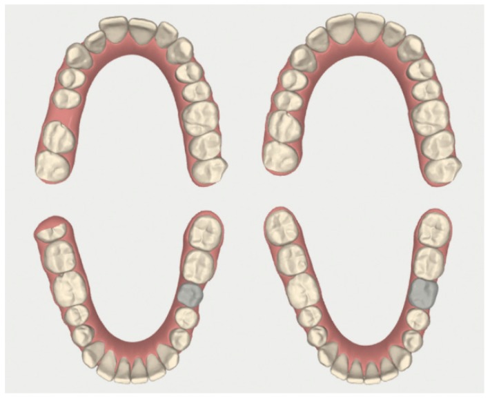 Figure 15