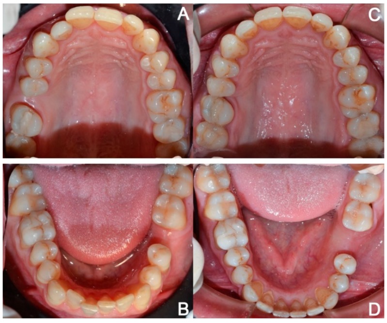 Figure 12