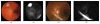 Fig. 14