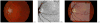 Fig. 38