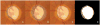 Fig. 15