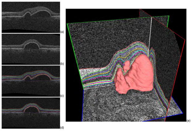 Fig. 30