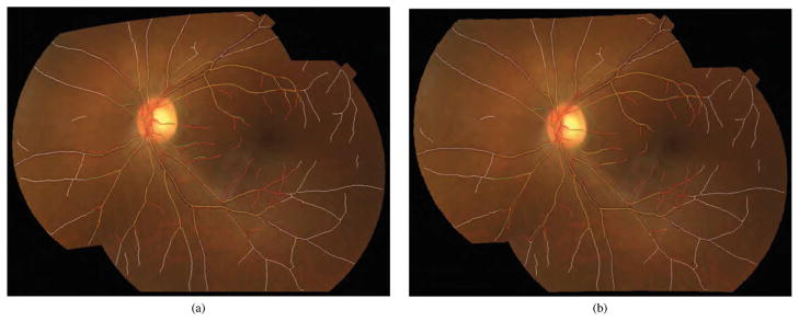 Fig. 11