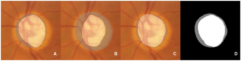 Fig. 15