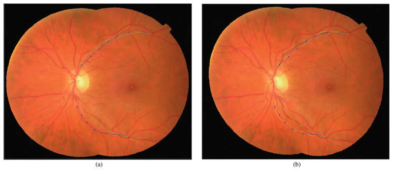Fig. 13