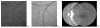 Fig. 36