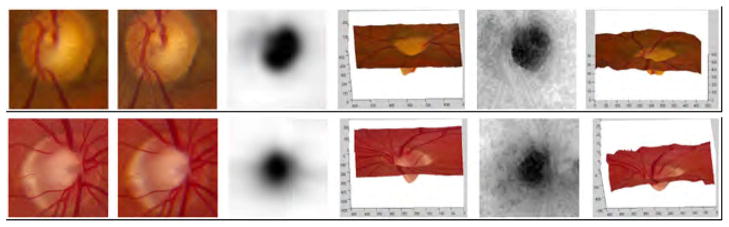Fig. 18