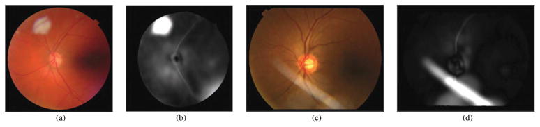 Fig. 14