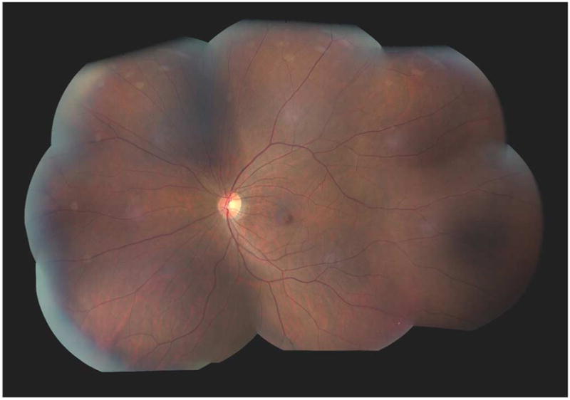 Fig. 37