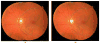 Fig. 13