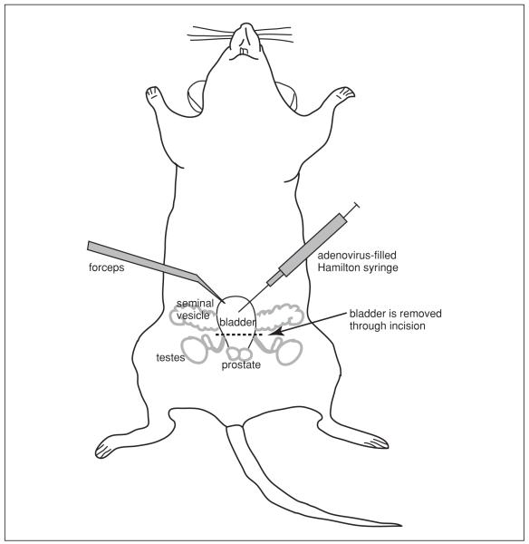 Figure 14.14.1