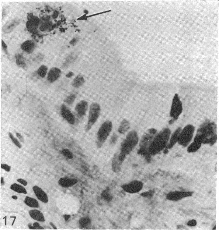 Fig. 17