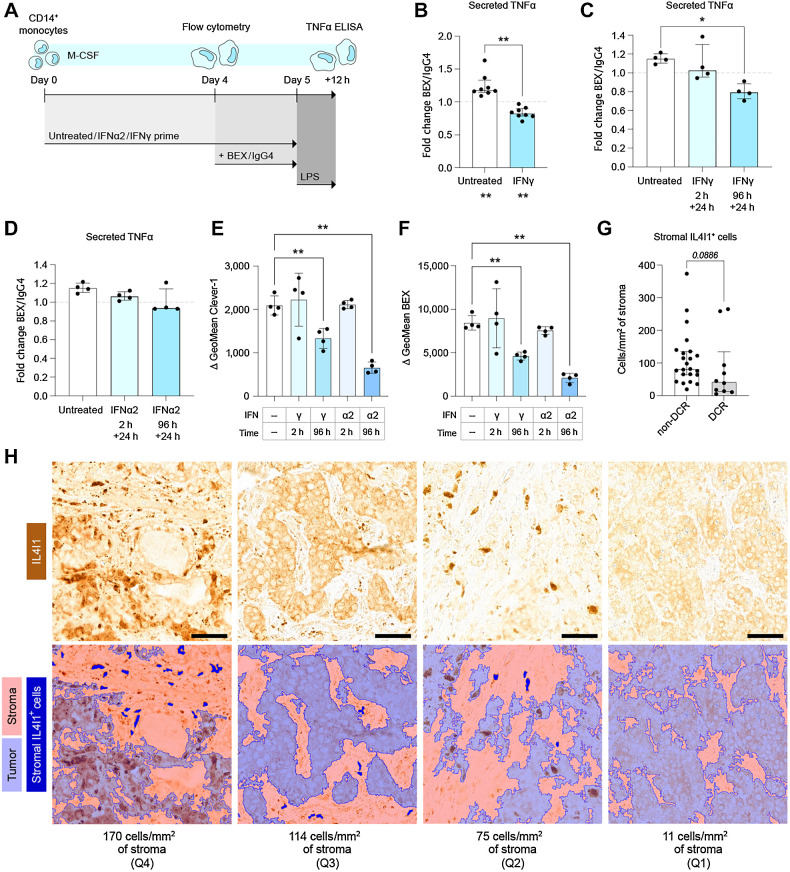 Figure 4. Chronic IFN priming inhibits further macrophage activation by bexmarilimab. A, Schematic showing timeline for primary human macrophage differentiation and simultaneous IFN priming, followed by bexmarilimab treatment and measurement of LPS response. B, TNFα secretion after bexmarilimab treatment in unprimed or IFNγ-primed macrophages (n = 8 healthy donors, two independent experiments). Median ± IQR, Wilcoxon signed rank tests for each group and Wilcoxon matched-pairs signed rank test. C and D, TNFα secretion after bexmarilimab treatment in macrophages primed with IFNγ (C) or IFNα2 (D). Acute priming (2 hours before and 24 hours during antibody treatment) and chronic priming (96 hours before and 24 hours during antibody treatment) are shown for n = 4 healthy donors. Median ± IQR, Friedman test followed by Dunn test. E and F, Macrophage Clever-1 expression (E) and abundancy of available bexmarilimab epitope (F) on day 4 after no priming, 2 hours, or 96 hours of indicated IFN priming. Mean ± SD, RM one-way ANOVA followed by Dunnett test. G, IL4I+ stromal cell abundancy in pretreatment biopsies collected from patients with (DCR, n = 10) and without (non-DCR, n = 23) disease control during bexmarilimab therapy in MATINS trial. Median ± IQR; Mann–Whitney U test. H, Representative images of MATINS pretreatment biopsies displaying a range of different stromal IL4I1+ cell densities (image per each quartile of cell densities). IL4I1 staining (top), detected tumor areas (bottom; light blue), detected stromal areas (bottom; light red) and detected stromal IL4I1+ cells (bottom; dark blue) are shown. Scale bars, 50 μm. *, P < 0.05; **, P < 0.01; BEX, bexmarilimab; IgG4, isotype control for bexmarilimab.