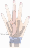 Figure 14