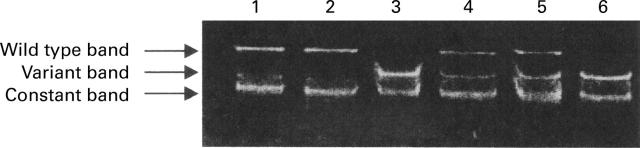 Figure 2  