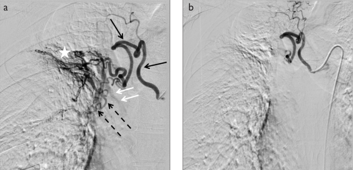 Figure 1. a, b