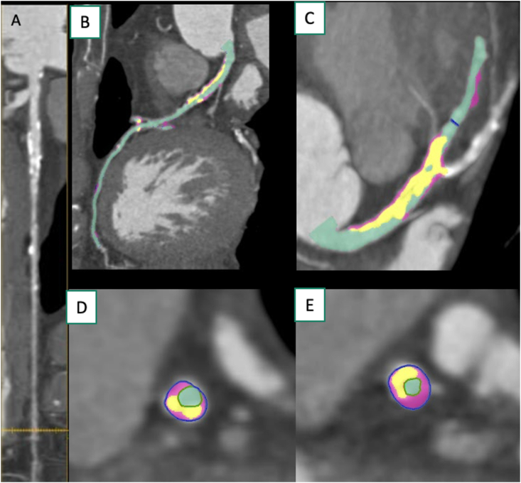 Figure 3