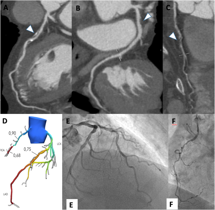 Figure 4