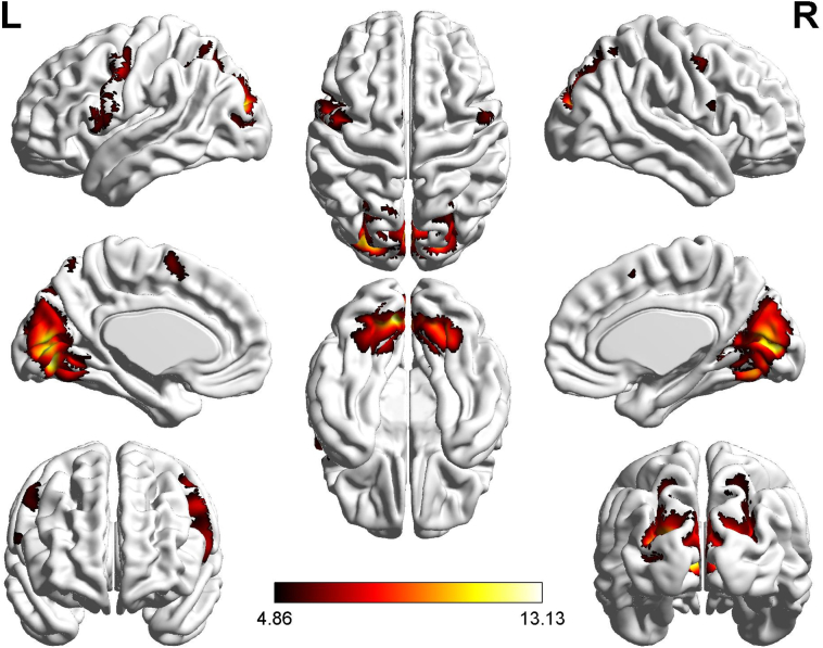 Fig. 4