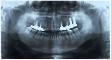 Fig. 7