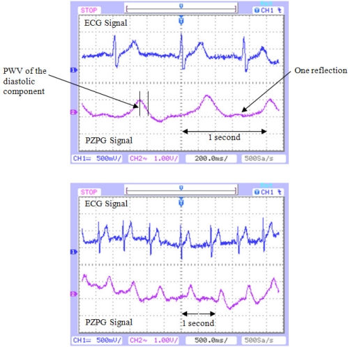 Figure 12.