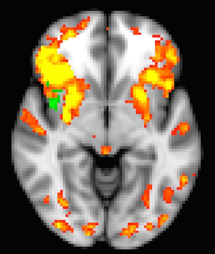 graphic file with name awv189fig1g.jpg