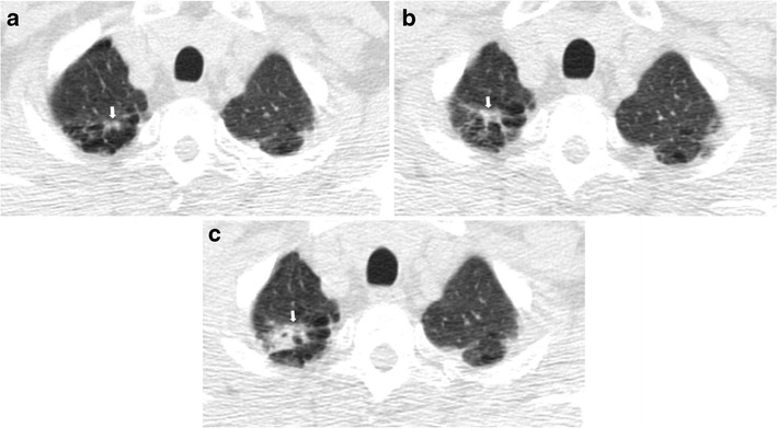 Fig. 11