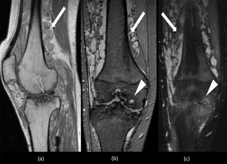 Figure 13.