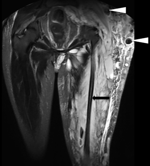 Figure 10.