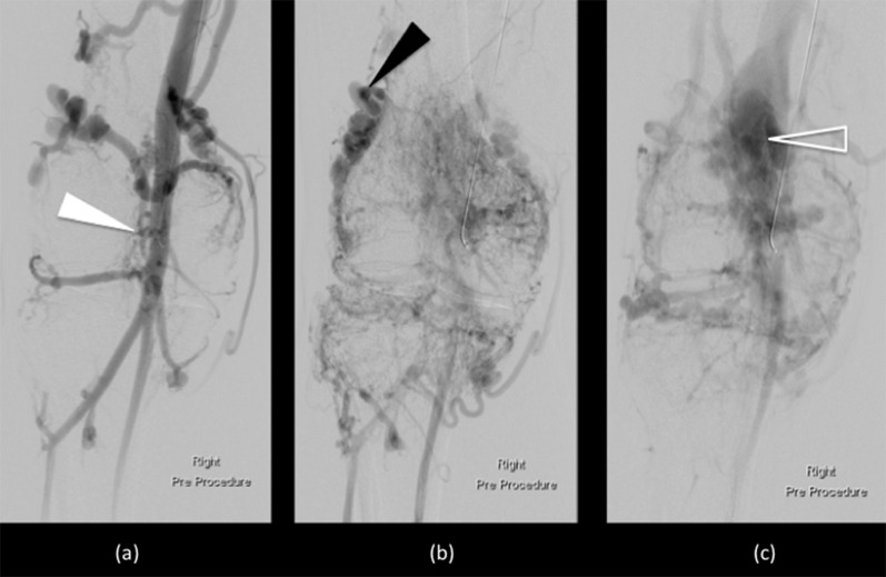 Figure 16.