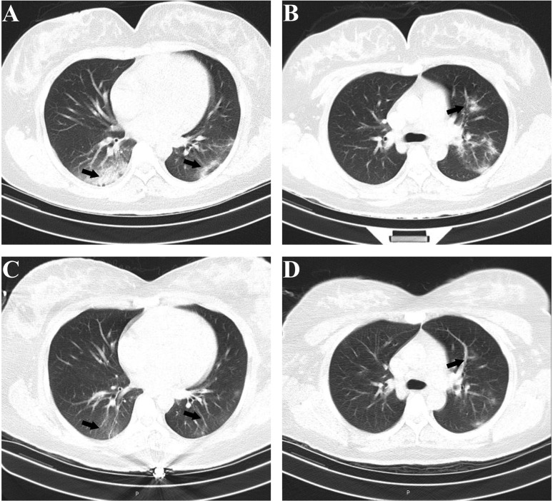 Fig. 1