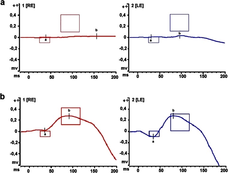 Fig. 4