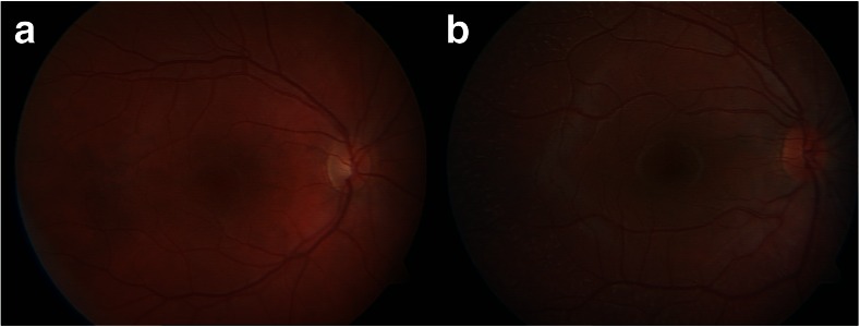 Fig. 3