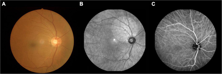 FIGURE 1