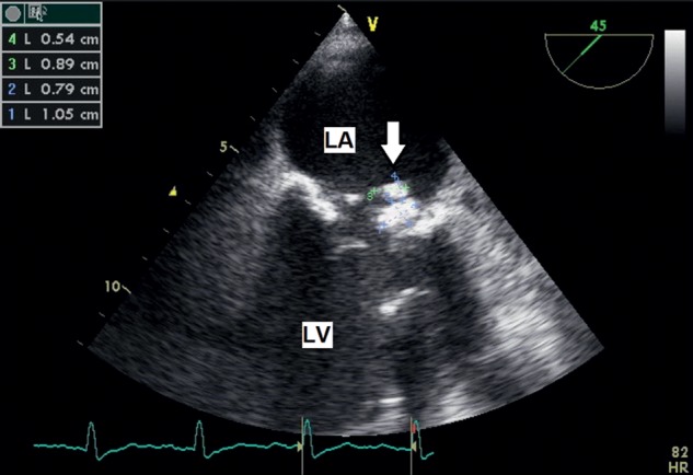 Figure 1: