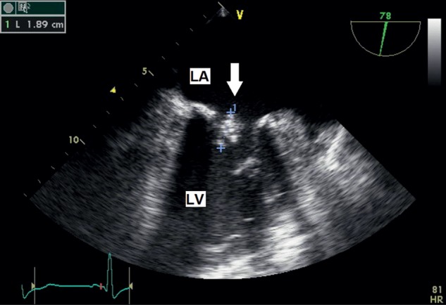 Figure 2: