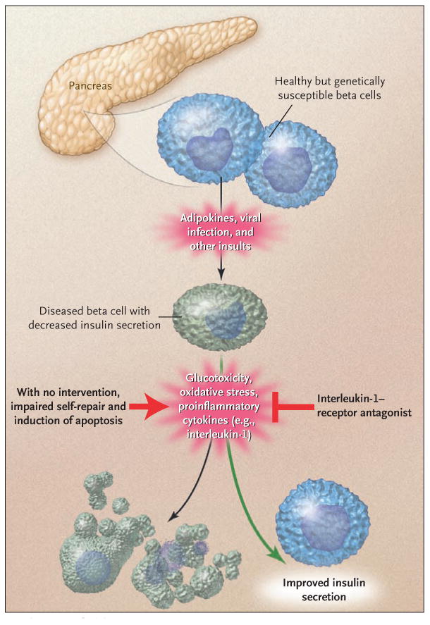 Development of Diabetes